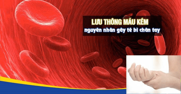 Thiếu máu nuôi do lưu thông máu kém - Nguyên nhân gây ra tê tay phải