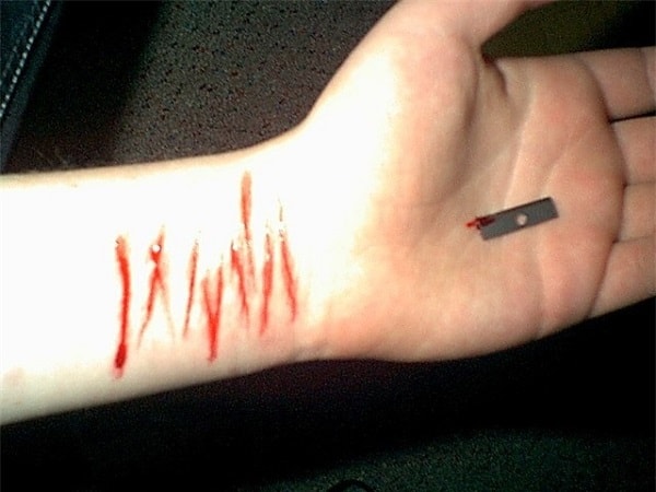 Triệu chứng tự hành hạ bản thân ở nhiều bạn trẻ Triệu chứng tự hành hạ bản thân ở nhiều bạn trẻ