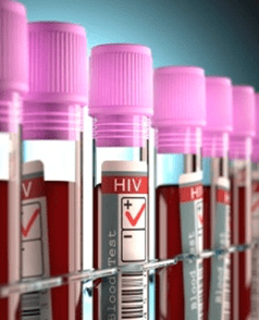 Bị phơi nhiễm HIV nên làm xet nghiệm để kiểm tra