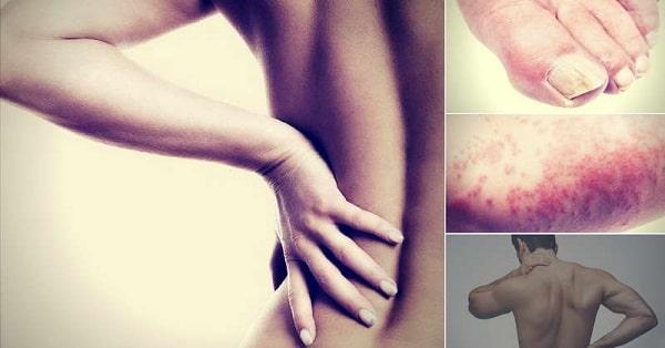 Làm thế nào để biết mình có bị nhiễm bệnh hiv?
