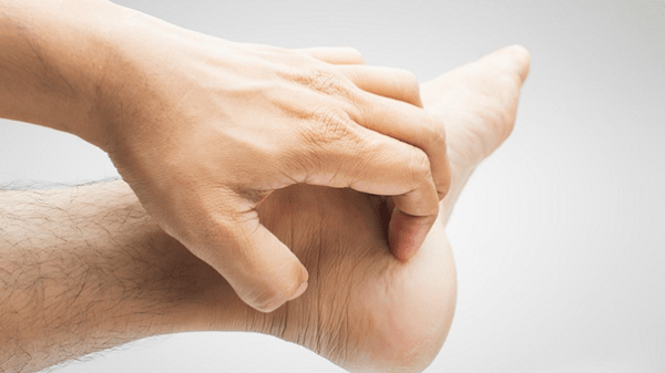 Làm thế nào để chẩn đoán bệnh ngứa gan bàn chân?
