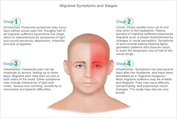 Nguyên nhân của bệnh đau nửa đầu Migraine