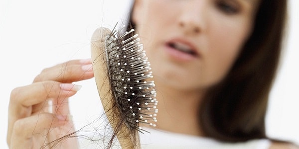 Các nguyên nhân gây rụng tóc từng mảng alopecia areata  Vinmec