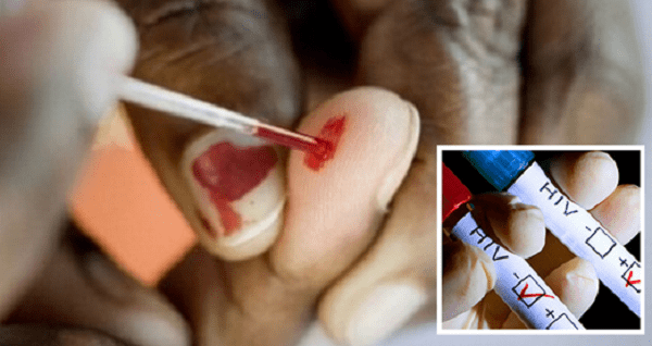 Những lưu ý trong phòng chống lây nhiễm HIV qua đường máu