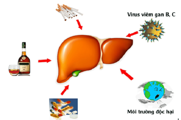 Những nguyên nhân gây ra bệnh viêm gan C là gì