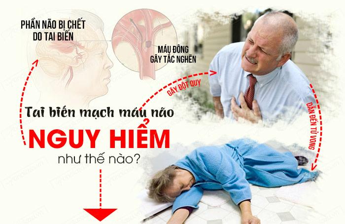 Phác đồ điều trị tai biến mạch máu não