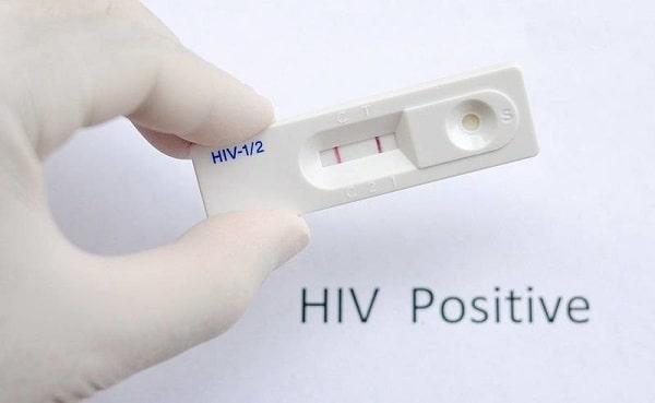Phải làm gì sau khi được chẩn đoán bị dương tính với HIV?
