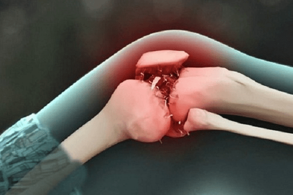 Phòng chống bệnh tràn dịch khớp gối như thế nào
