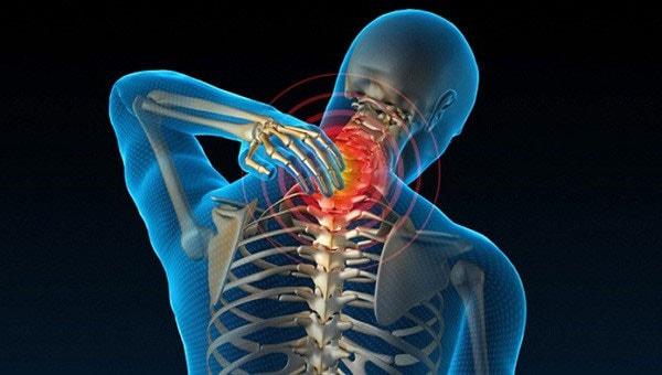 Triệu chứng đau cột sống cổ - nguyên nhân và cách chữa trị