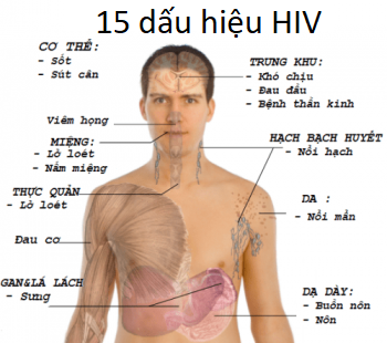Triệu chứng HIV: 15 dấu hiệu HIV thường gặp. Làm sao biết không bị ...