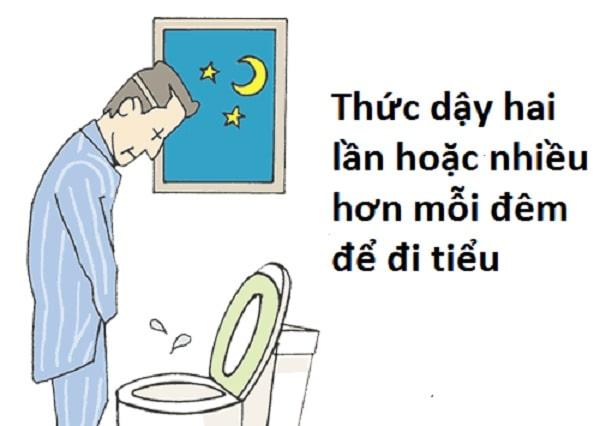 Triệu chứng nào giúp nhận biết nhanh bệnh tiểu đêm nhiều lần?