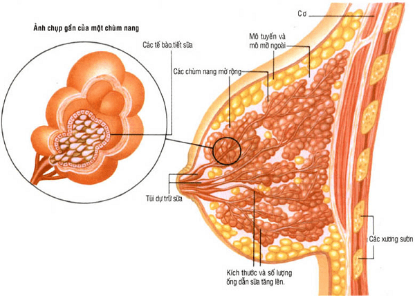 U nang tuyến vú có thể gây hại không?
