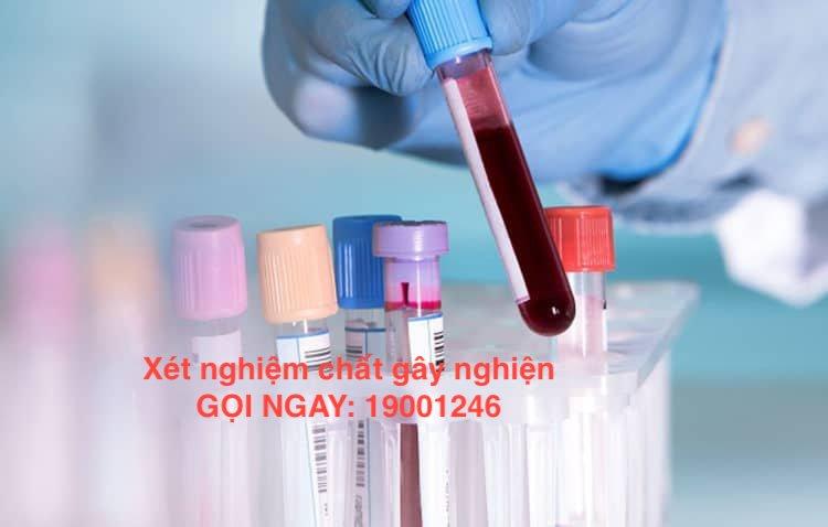 Xét Nghiệm Chất Gây Nghiện: Quy trình, Thời gian và Lưu ý