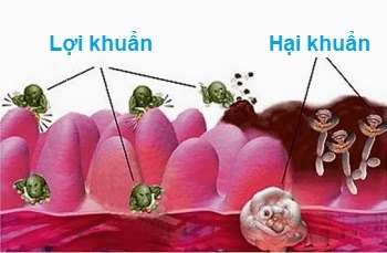 Lợi khuẩn đường ruột bảo vệ đại tràng khỏe mạnh
